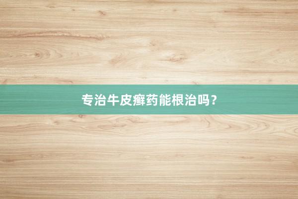 专治牛皮癣药能根治吗？